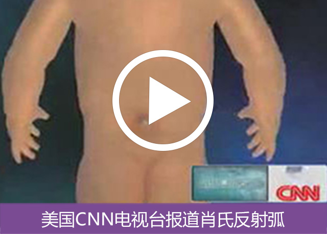 美国CNN电视台报道肖氏反射弧手术